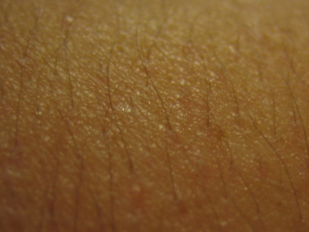 kp-and-other-diseases-that-cause-bumps-on-skin-keratosis-pilaris-help