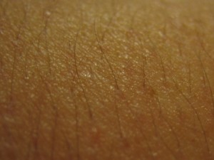 Diseases that Cause Bumps On Skin